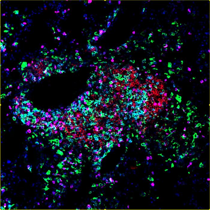 Researchers Identify Immune Cell That Builds Cancer-Fighting Hubs Inside Tumors