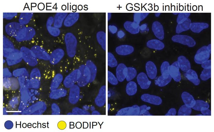 Reduced lipid droplets