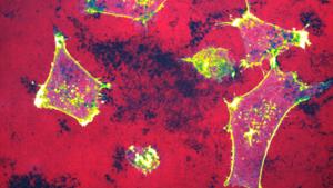Cancer cells degrading their surrounding matrix