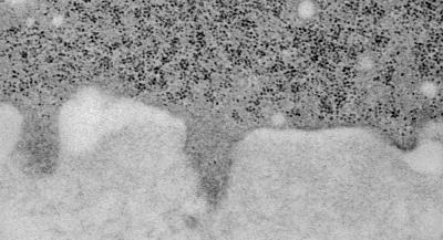 Cancer Cell with Invadopodia