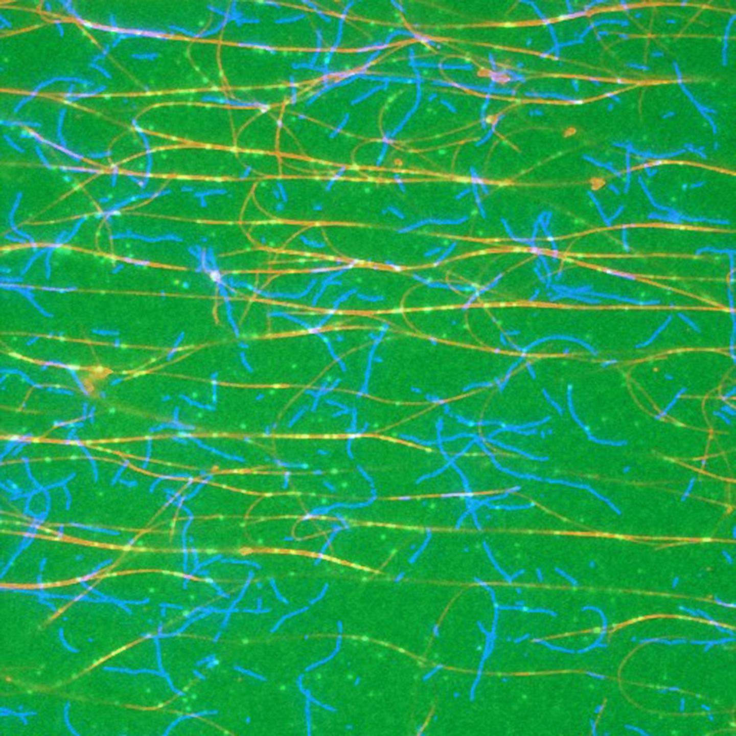 A Cell's Cytoskeleton