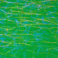 A Cell's Cytoskeleton
