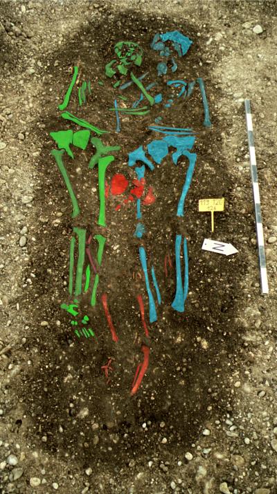 Skeletal Remains (1 of 2)