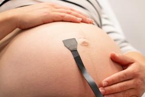 wearable ultrasound patch for pregnancy - 1