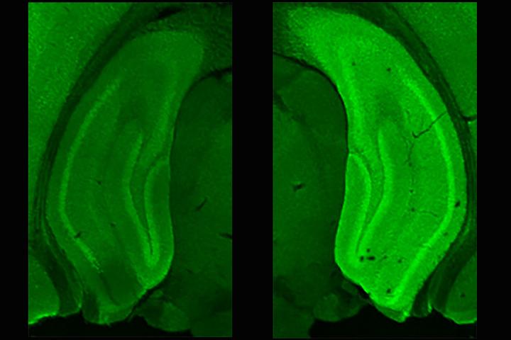 Novel Contexts Upregulate Neurogranin