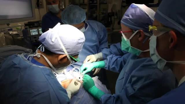 Surgeons Remove Thyroid Gland Through Incision Underneath Lip (TOETVA)