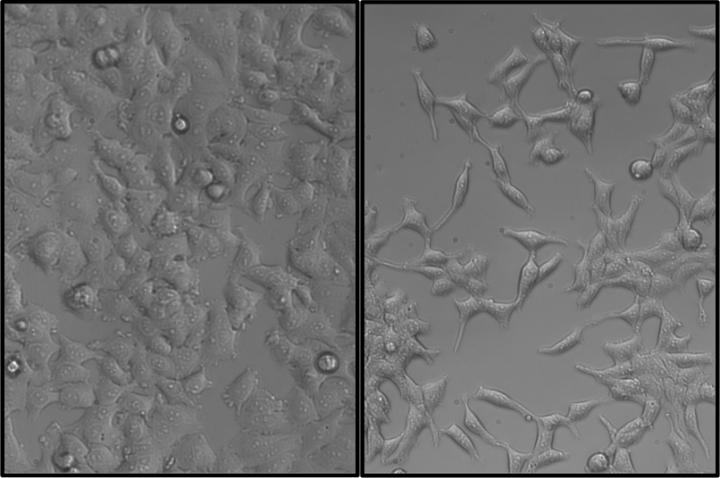MCF-7 Cells