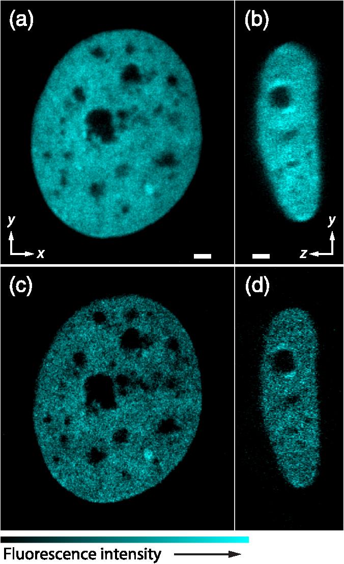 Fluorescence Images of a Living HeLa Cell