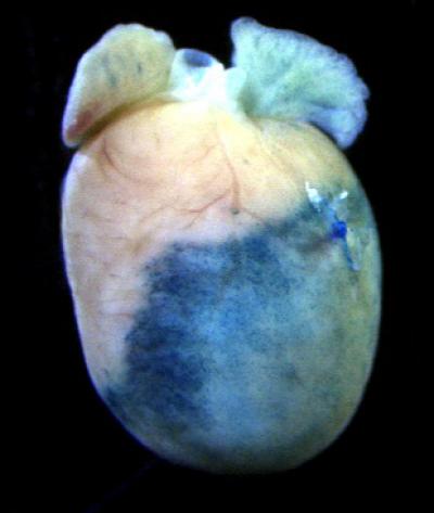Re-awakening the Heart's Healing System (1 of 2)
