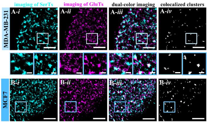 Figure 3. Compared analysis of the assembly and co-localization of SerTs and GluTs on MCF7 and MDA-MB-231 cells.