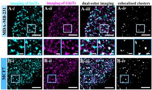 Figure 3. Compared analysis of the assembly and co-localization of SerTs and GluTs on MCF7 and MDA-MB-231 cells.