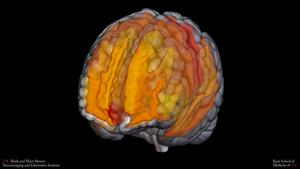 Gray and white matter