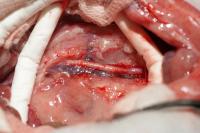 Blood Vessel