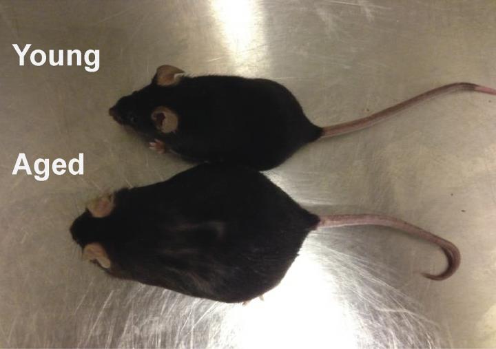 Obesity and Cancer Immunotherapy