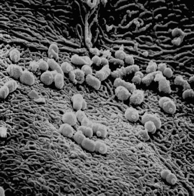 <I>Streptococcus equi</I>