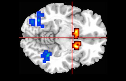 Brain Scan