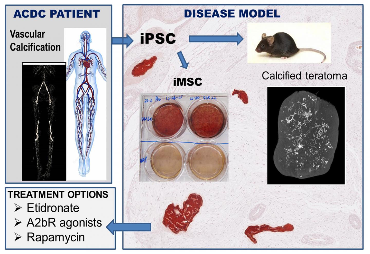 Patient-Derived Stem Cells Reveal Treatment Strategies for Rare Arterial Disease (1 of 2)