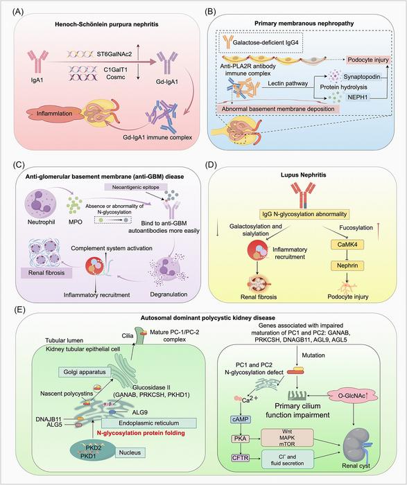 Aberrant Glycosylation Drives Kidney Disease Pathogenesis.