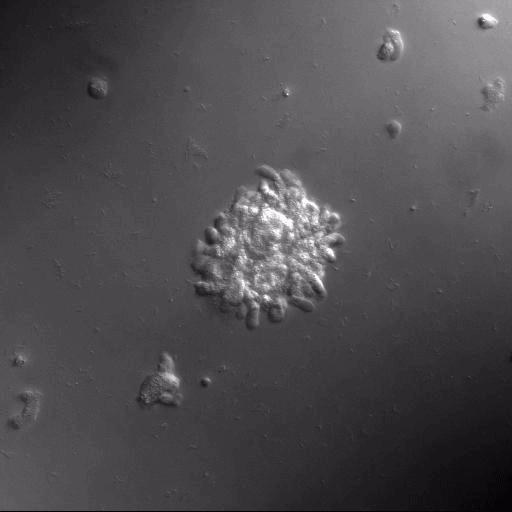 Protein Tails Determine Compatibility Between 'Slime Mold' Mates (1 of 4)
