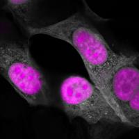 Salk Institute -- HSU lab -- CasRx