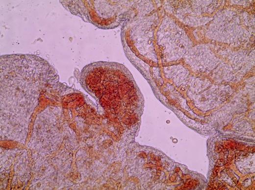 UoM Embryo