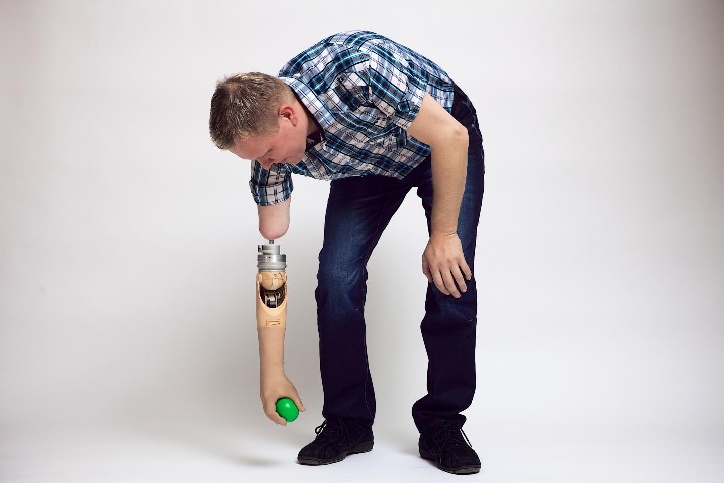 Prosthetic Hands & Arms that 'Belong' (3 of 12)
