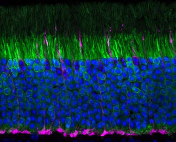 Mouse Retina Showing Rods and Cones