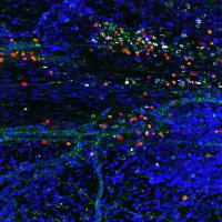 Immune Cells -- Missing Link?