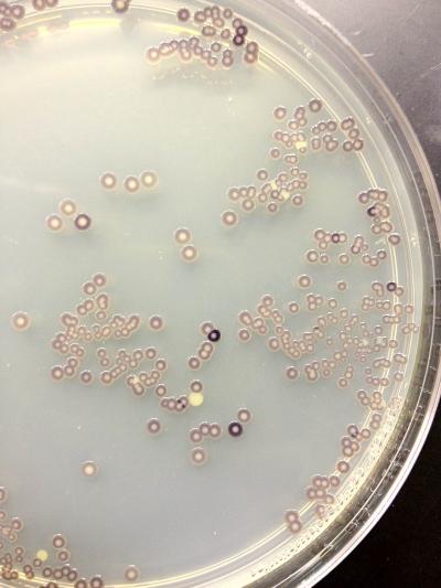 Bacteria Pushes Button for Tubeworm Metamorphosis (8 of 9)