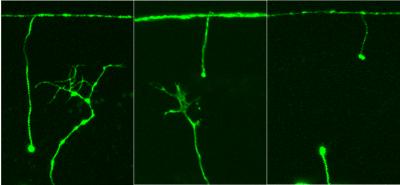 Ugly, Good and Bad Nerve Regeneration