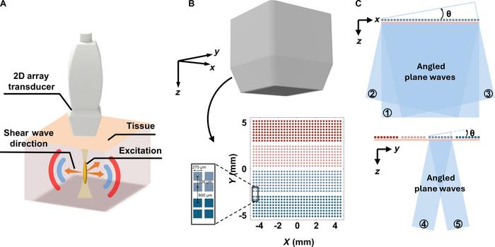Schematic diagram of 3D SWE and transmit–receive strategy