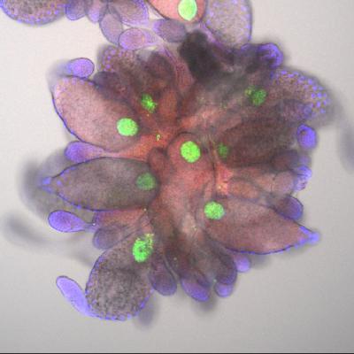 Asian Citrus Psyllid Eggs