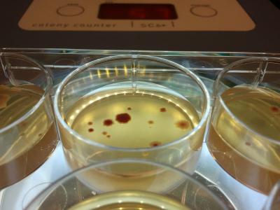 Mutated <em>E. coli</em> Bacteria (1 of 2)