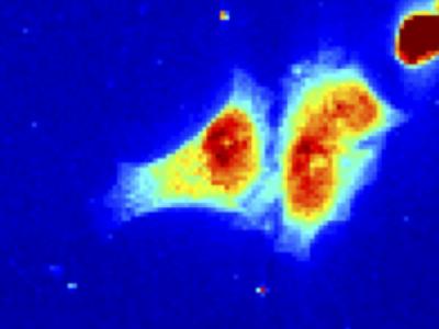 X-ray Scan of a Biological Cell