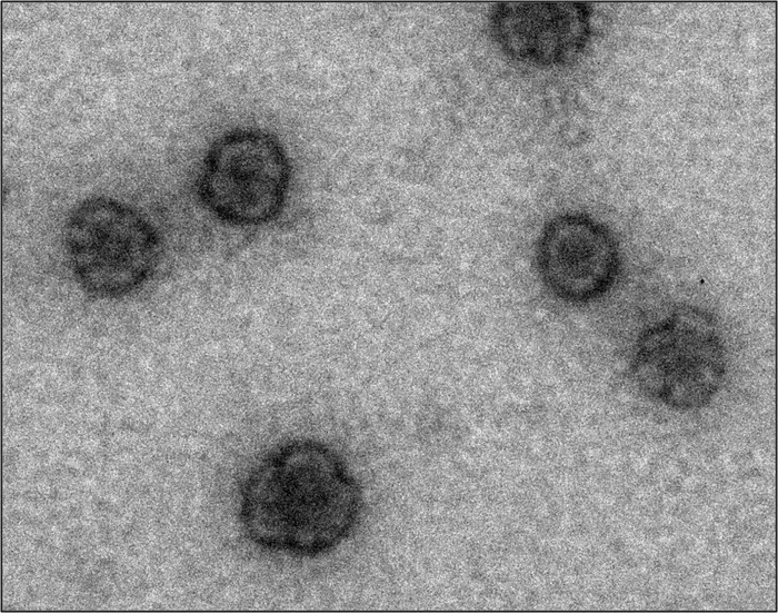 antifungal nanoparticles TEM