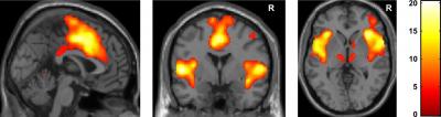 When in Pain, Gloomy Outlook Proves True (2 of 3)