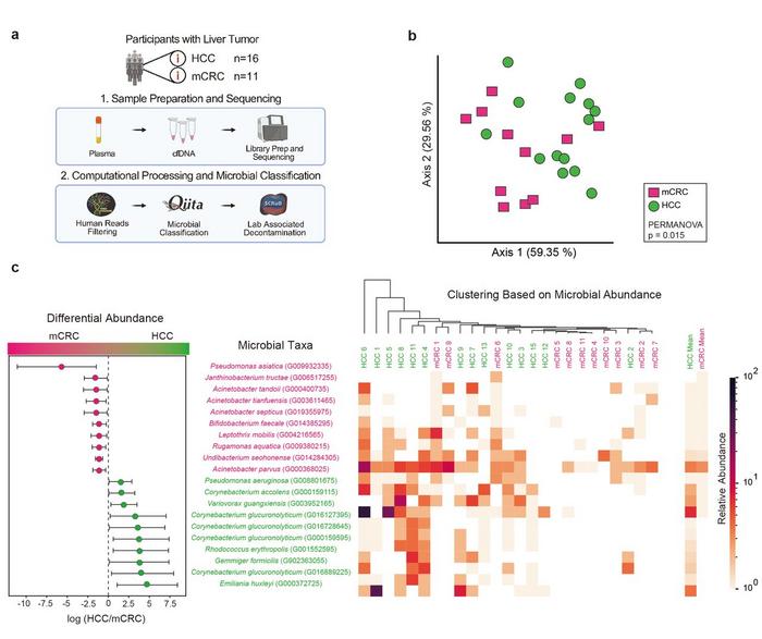 Plasma microbial signatures of patients with liver tumours.