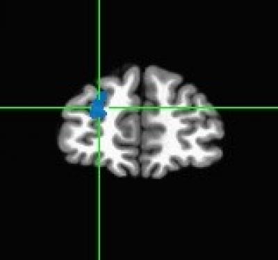 Left Superior Frontal Region
