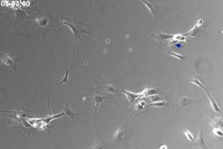New Human Neurons from Adult Cells Right There in the Brain