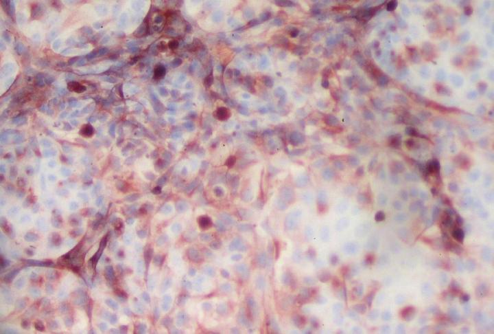 A Minibrain Triculture