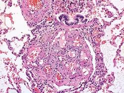 Lung Tissue
