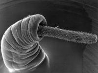 <i>Echinorhynchid acanthocephalan</i>