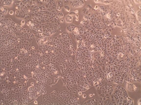 Glut Cells