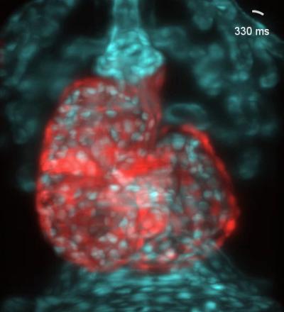 Zebrafish Heart