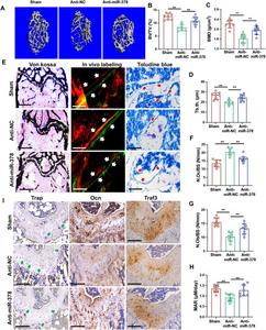 Anti-miR-378 lentivirus injection rescued ovariectomy induced bone loss in miR-378 Tg mice.