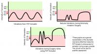 How the PZT Actuator Can Improve Sensation for Surgeons During Minimally Invasive Surgeries