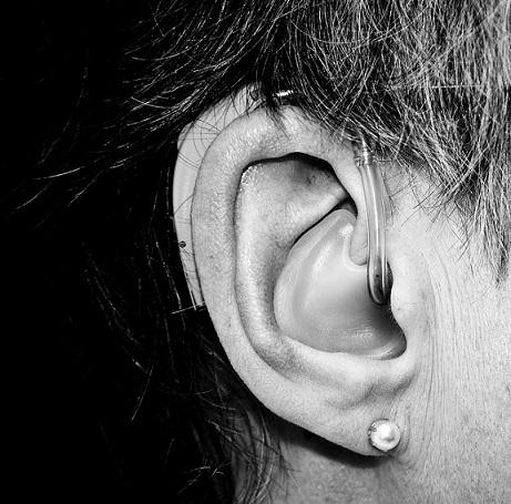 Electronic Records Help Identify Two Genes Linked to Age-Related Hearing Impairment
