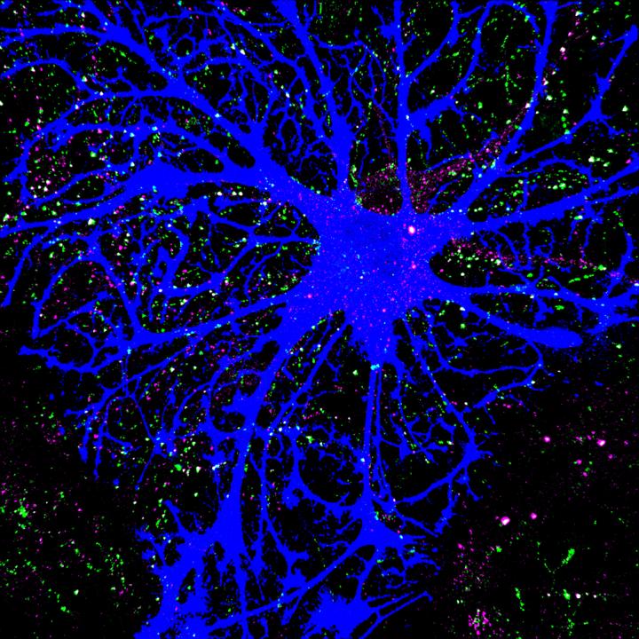 Astrocyte