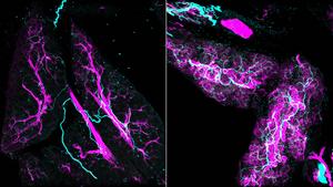Stress signals redesign tissues during inflammation and cancer