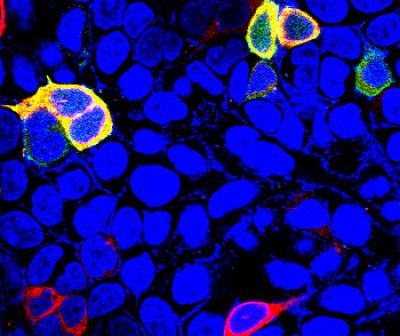 Sestrin 3 Protein